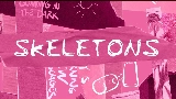 Miniatura do vídeo Skeletons